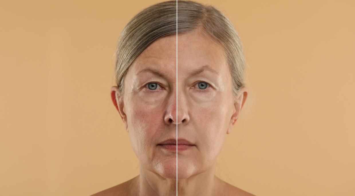 Anti-aging