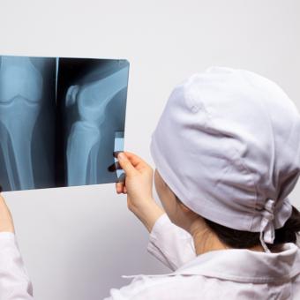 Proč se ženám lámou kosti častěji? Riziko roste po menopauze, upozorňuje Kateřina Cajthamlová