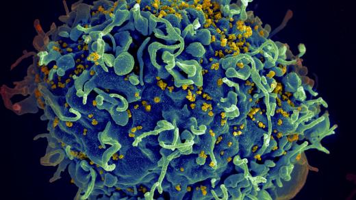 Virus HIV