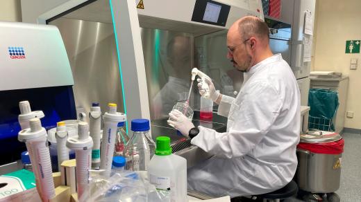 Virus opičích neštovic se začal šířit také na Západ.