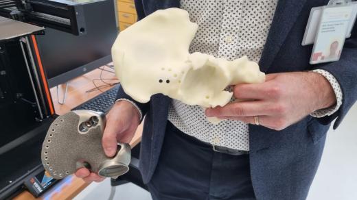 V Ústí nad Labem začala fungovat 3D laboratoř. Lékařům může pomoci s lepším plánováním operací