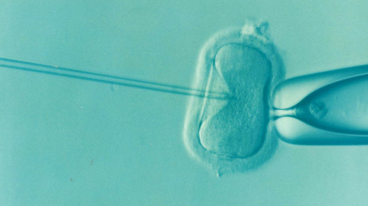 IVF, umělé oplodnění
