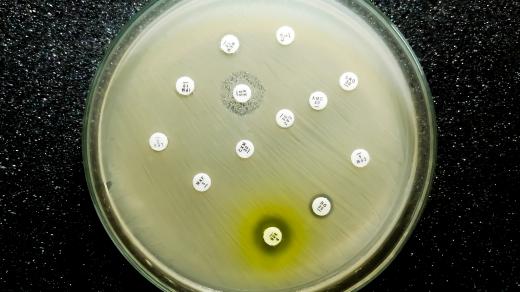 Výzkum antibiotik (ilustrační foto)