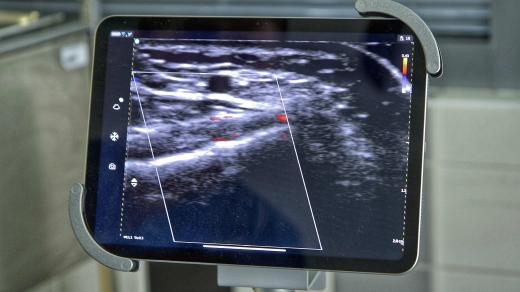 Fakultní nemocnice v Hradci Králové má nové bezdrátové ultrazvukové přístroje za 2,5 milionu korun