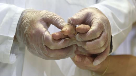 Chirurgie ruky (ilustr. foto)