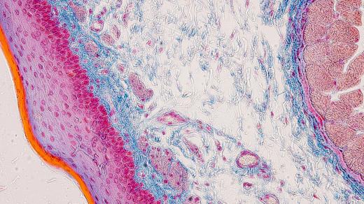 Histologie, patologie, tkáňový řez (ilustrační foto)