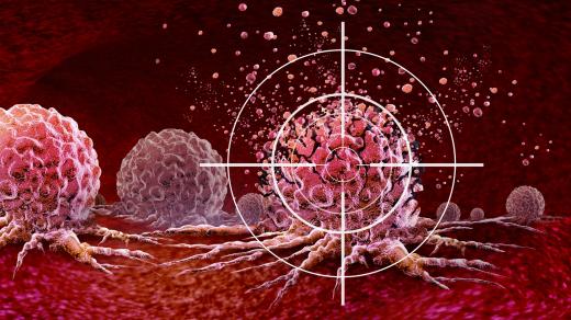 Lymfomy. Novinková léčba nádorů cílenou imunologickou terapií