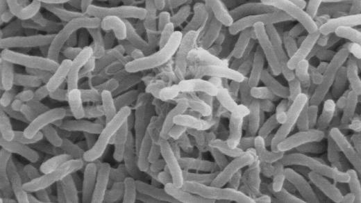 Bakterie Vibrio cholerae pod elektronovým mikroskopem