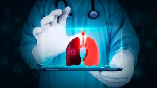 Idiopatická plicní fibróza