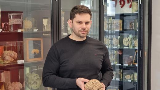 Přednosta Anatomického ústavu Marek Joukal drží v rukou lidský mozek konzervovaný unikátní metodou tzv. plastinace