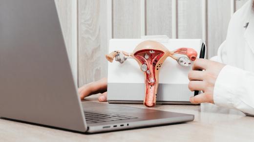 Endometrióza (ilustrační foto)