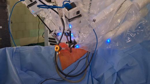 Robotická operace nádoru plic