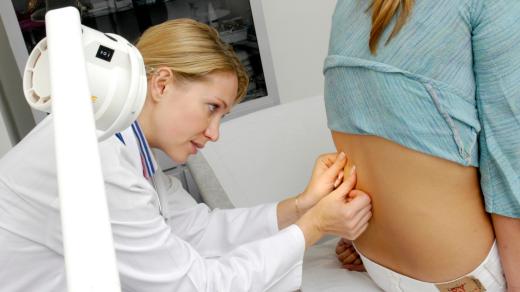 Vyšetření kožního znaménka, prevence, melanom (ilustrační foto)