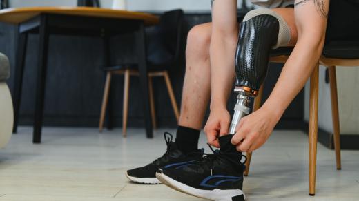 Protetika (ilustrační foto)