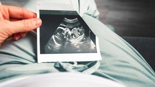 Těhotná žena by měla během těhotenství podstoupit nejméně tři ultrazvuková vyšetření. Ilustrační foto