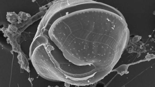 Obrněnka Protoperidinium achromaticum