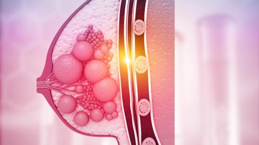 Moci bez nemoci: Novinková možnost genomického testování a léčby na míru pro pacientky s rakovinou prsu
