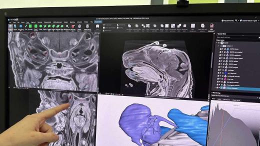 65 tisíc odstínů šedi detailně odhaluje různé struktury: kosti, měkké tkáně, svaly, chrupavku