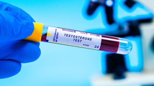 Moci bez nemoci: Úbytek testosteronu u mužů