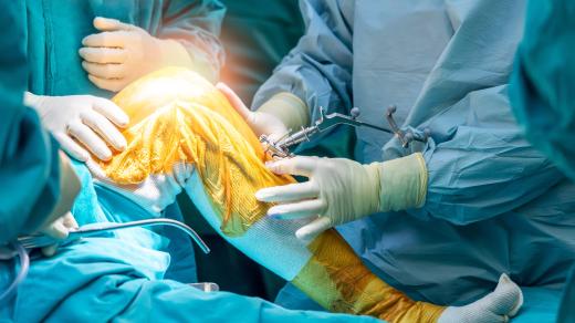 Robotická operace kolene