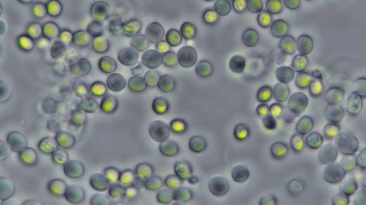 Kvasinky pod mikroskopem