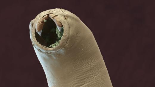 Střevní parazit měchovec (Ancylostoma ceylanicum)