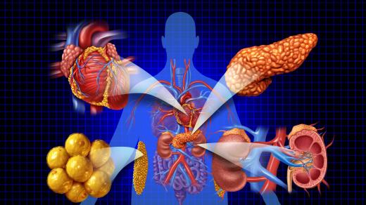 Moci bez nemoci: Kardio-reno-metabolický syndrom