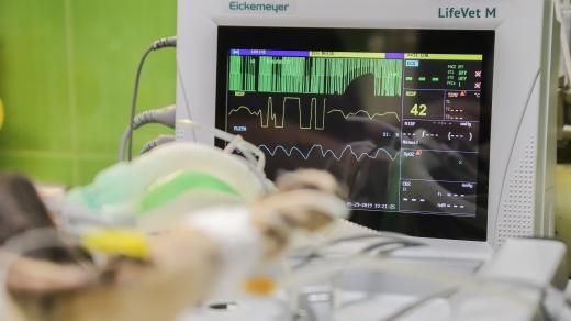 EKG