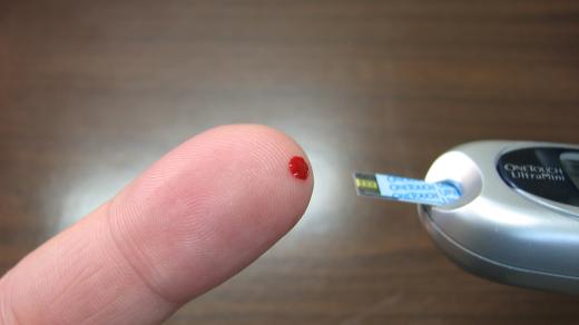 Diabetes (ilustrační foto)