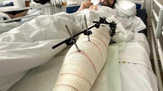 Pan Karel z České Lípy se zranil při jízdě na elektrokoloběžce