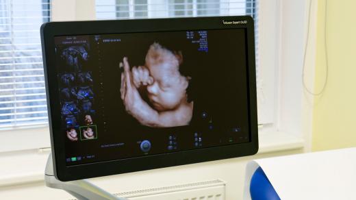 Výzkumné ultrazvukové pracoviště Fakultní nemocnice Hradec Králové