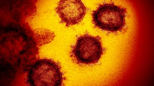 Virus SARS-CoV s viditelnou koronou