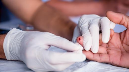 Testování (AIDS/HIV)