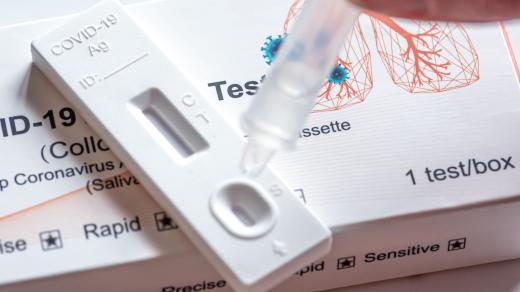 Antigenní test