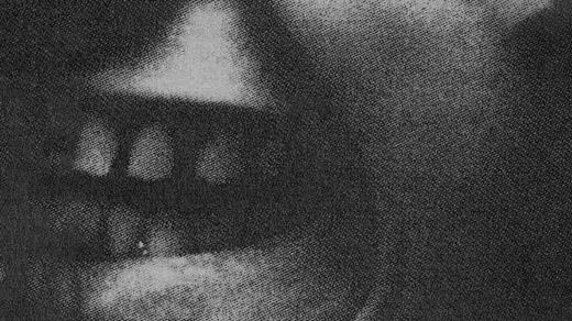 Slowthai a jeho zuby