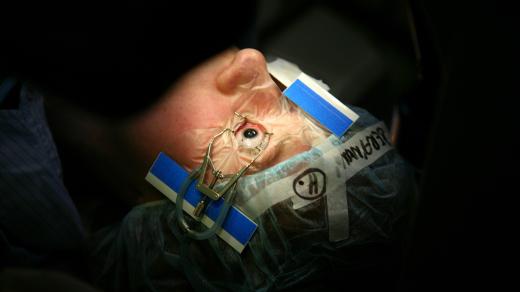 Operace očí (ilustrační foto)