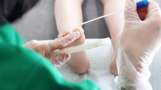 Onemocnění nehtů (ilustrační foto)